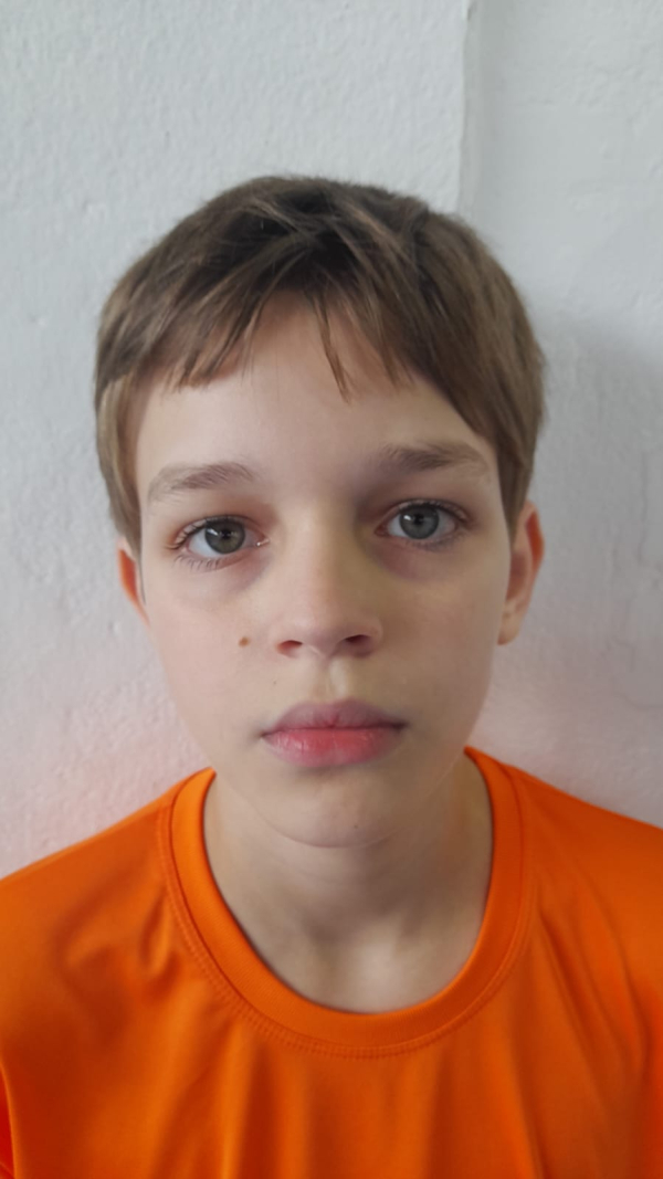 DAVI