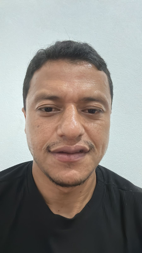 GODOY