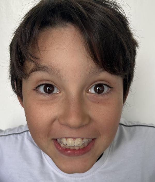 Benício